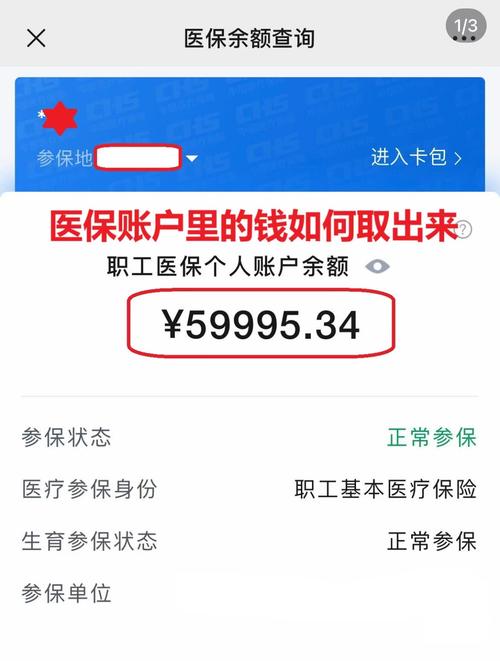 圣康医保在线提取新政策解读：你的医保余额真的能随时变现吗？